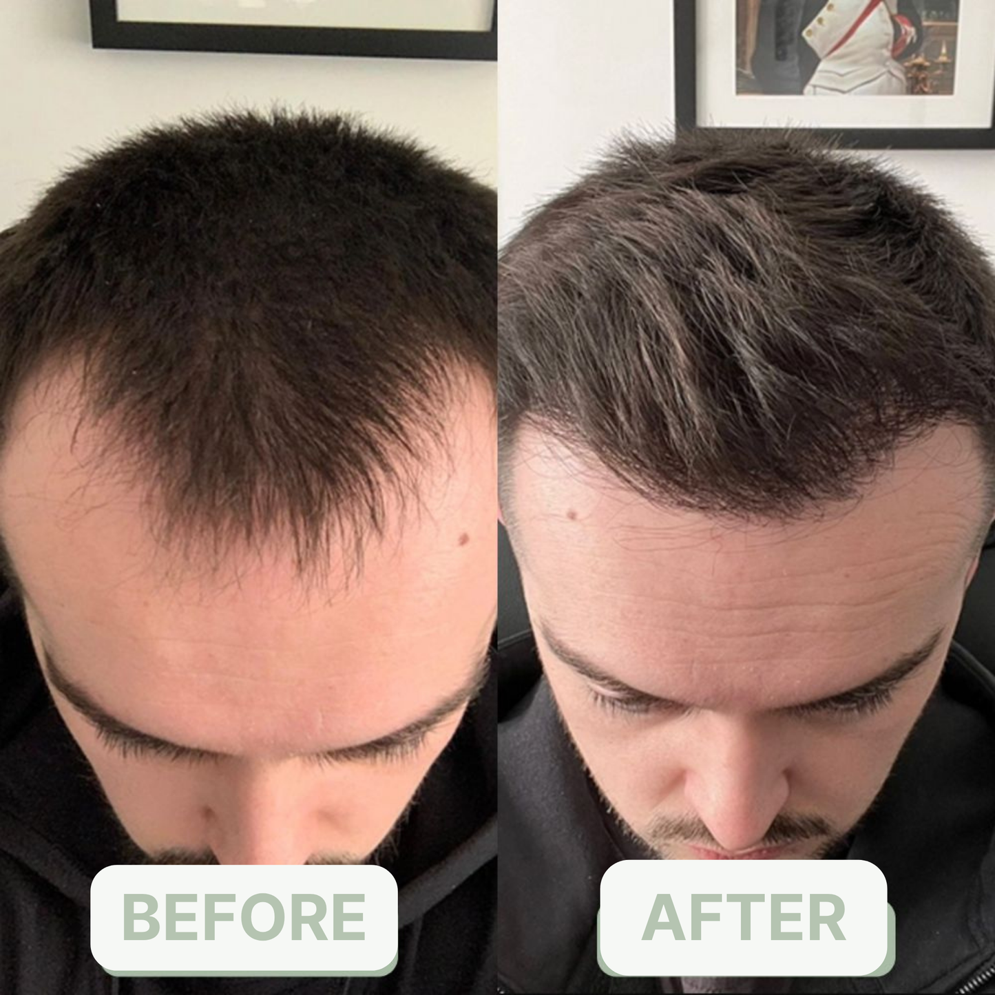 Hair Growth Serum Oil Roll-on - native. men