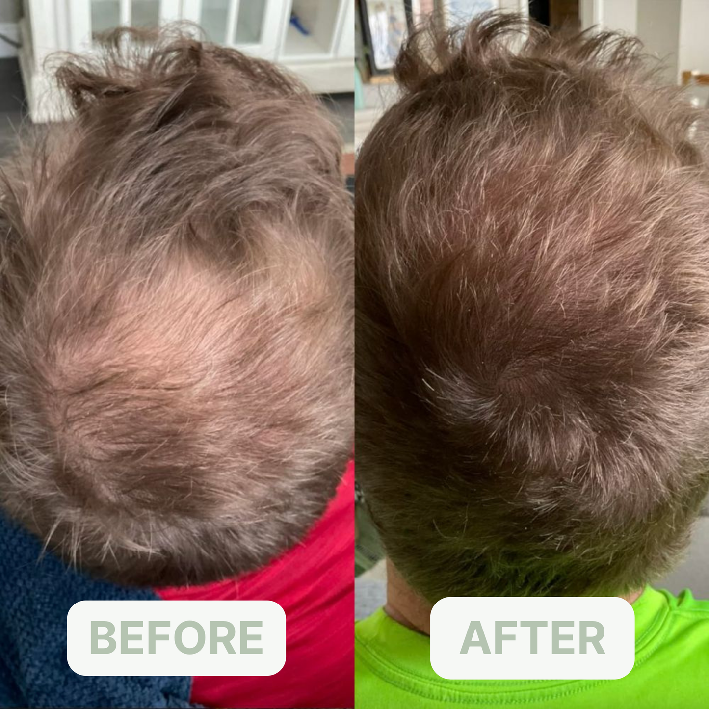 Hair Growth Serum Oil Roll-on - native. men